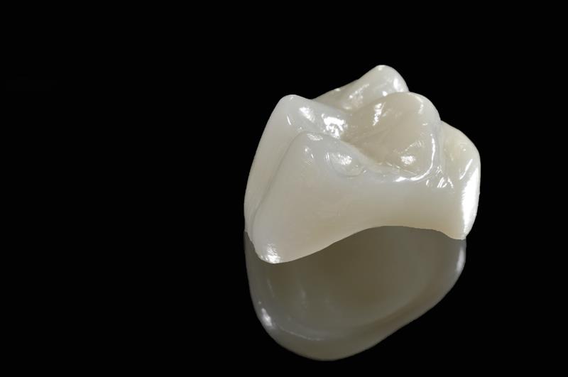 Porcelain Crowns Los Angeles, CA
